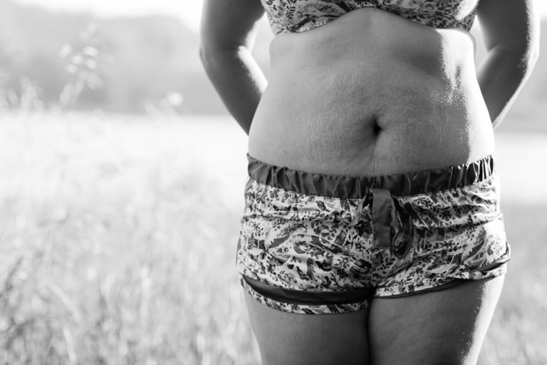 black and white close up of the effects pregnancy often has on a woman's stomach