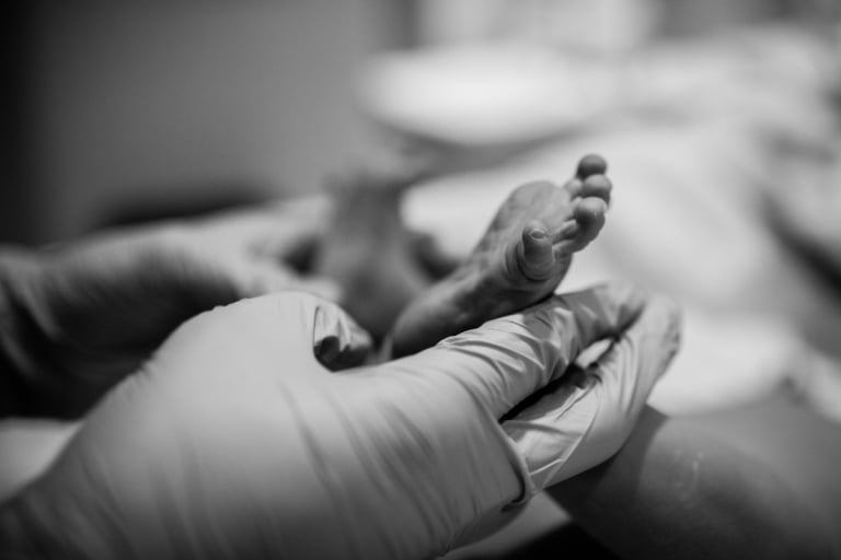 black and white detail shot of newborn's tiny foot as the midwife checks her over
